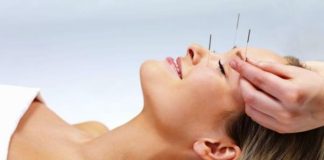 Akupunktur tedavisi nasıl yapılır? Etkileri nelerdir?