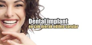 Dental implant ve diş tedavisi hakkında her şey
