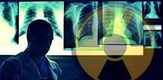 Erciyes Üniversitesi'nde 12 röntgen teknisyeninde tiroid kanseri