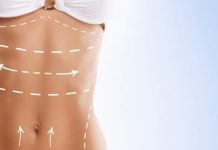 Liposculpture uygulaması ile yağlarınızdan kurtulabilirsiniz