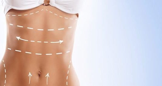 Liposculpture uygulaması ile yağlarınızdan kurtulabilirsiniz
