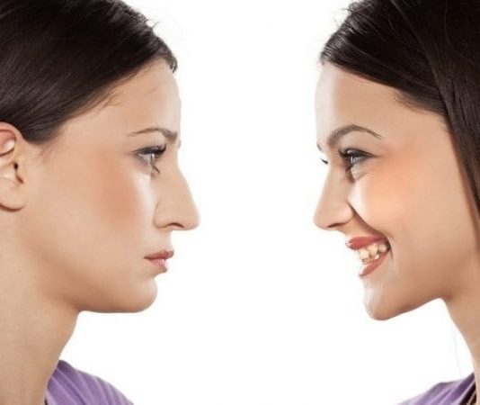 Burun estetiği: İşler yolunda gitmezse ne yapmalı?