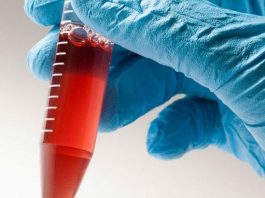 Türk hematologlar "Kordon Kanı" için buluştu