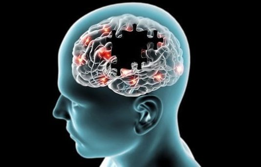 ALS hastalığı nedir? Belirtileri nelerdir?