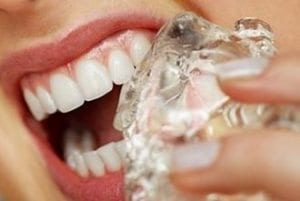 Diş çürümesini hızlandıran yiyecek ve maddeler neler buz yemenin zararları