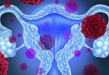 Kadınlarda en sık rastlanan üç kanser türü hangileridir?