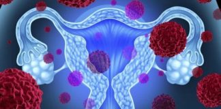 Kadınlarda en sık rastlanan üç kanser türü hangileridir?