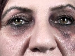 Kadınız bilmeden seviyoruz (2)