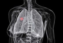 Sigara tüketimi insan DNA’sında mutasyona sebep oluyor Sigara tüketimi insan DNA'sında mutasyona sebep oluyor