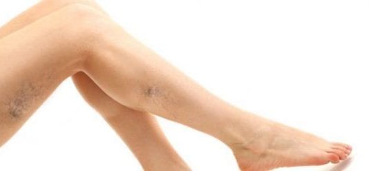 Varis daha çok kimlerde görülür? Önlemek için A harfi egzersizi