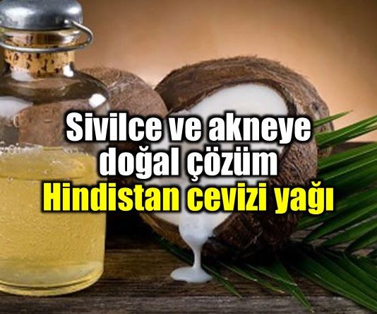 Hindistan cevizi yağı sivilce ve akne doğal çözüm