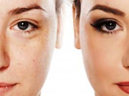 Altın iğne uygulaması nedir? Gerçekten işe yarıyor mu? yorumlar fiyatları