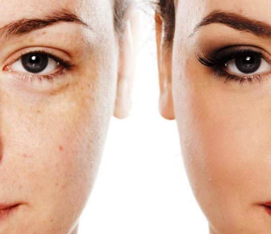 Altın iğne uygulaması nedir? Gerçekten işe yarıyor mu? yorumlar fiyatları