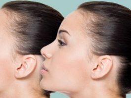 Burun estetiği ile ilgili bilmeniz gerekenler nelerdir?