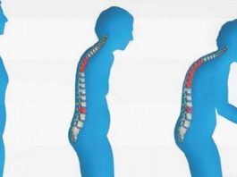 Menopoz kemiklerinizi eritmesin! Kemik erimesi tedavi edilebiliyor!