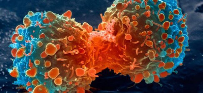 Kanserden korunmak için 7 önemli ipucu!