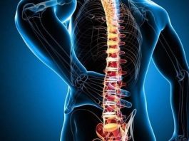 Omurilik tümörü nedir? Belirtileri ve tedavi şekli nasıldır?