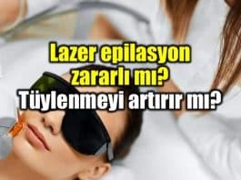 Lazer epilasyon zararlı mı? Tüylenmeyi artırır mı?