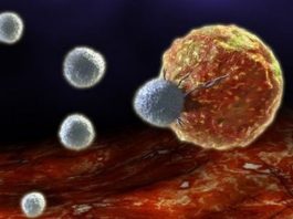 Pankreas kanserinin 10 işaretine dikkat!