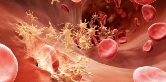 Hemofili nedir? Belirtileri ve tedavisi nasıldır?