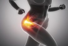Kalça kireçlenmesi (osteoartrit) nedir? Tedavisi nasıldır? Kalça kireçlenmesi (osteoartrit) nedir? Kimlerde görülür? Tedavisi nasıldır?