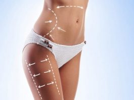 Liposuction sonrası aynı bölgede yağlanma oluşur mu?
