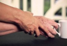 Parkinson hastalığının belirtileri nelerdir? Tedavisi var mı? Parkinson hastalığının belirtileri nelerdir? Tedavisi var mı?