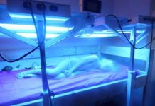 Sedef hastalığı belirtileri nelerdir? Tedavisi var mı?