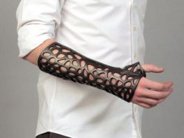 Kırıklar için yeni nesil tedavi: 3 Boyutlu alçılar