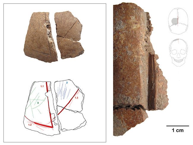 göbeklitepe göbekli tepe neolitik insan kemik kafatası