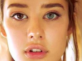 Heterokromi nedir? Neden oluşur? Çeşitleri neler?