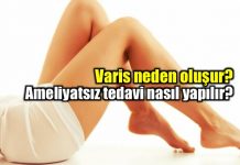 Varis hastalığı nasıl oluşur? Nasıl tedavi edilmeli?