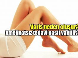 Varis hastalığı nasıl oluşur? Nasıl tedavi edilmeli?