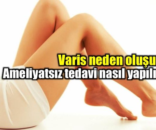 Varis hastalığı nasıl oluşur? Nasıl tedavi edilmeli?