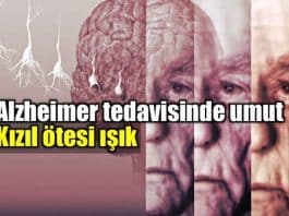 Alzheimer tedavisi için umut veren adım: Kızılötesi ışık