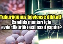 Candida mantarı nedir? Tükürük testi evde nasıl yapılır?