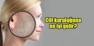 Cilt kuruluğu sorununa ne iyi gelir?