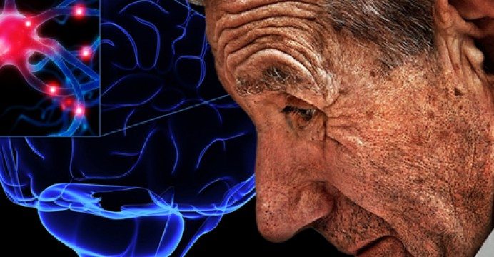 Parkinson hastalığının nedeni bağırsak florası olabilir mi?