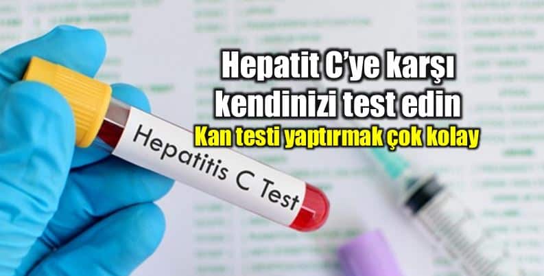 Hepatit C hastalığı Siroz hcv kan testi