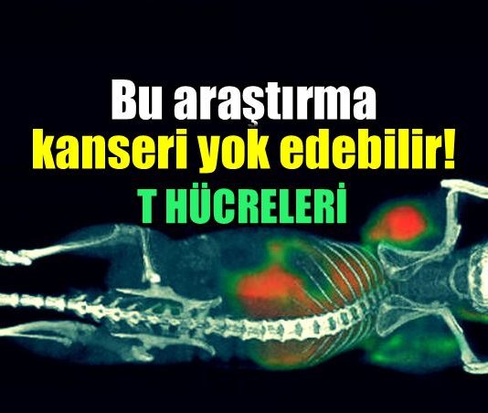Kanser tedavisi araştırmasında umut: T hücreleri