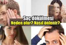 Saç dökülmesi neden olur? Nasıl önlenir? Saç dökülmesi nedenleri: Neden olur nasıl önlenir?
