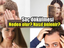 Saç dökülmesi nedenleri: Neden olur nasıl önlenir?