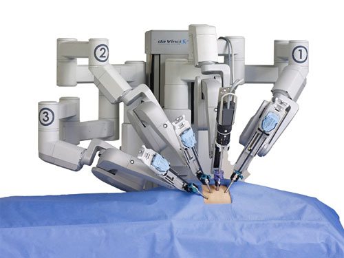 da vinci robotik cerrahi robot laparoskopi