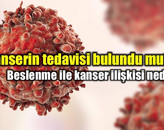 Kanserin tedavisi bulundu mu? Obezite beslenme kilo ile kanser ilişkisi nedir?