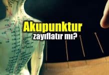 Akupunktur nedir? Akupunktur zayıflatır mı?