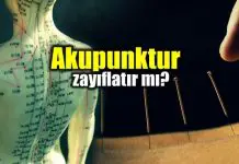 Akupunktur nedir? Akupunktur zayıflatır mı?