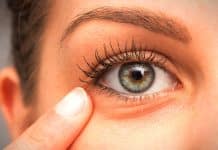 Göz altı morluk ve yaşlanma nedenleri: PRP ve mezoterapi nedir? Göz altı çevresi yaşlanma nedenleri: PRP ve mezoterapi nedir?