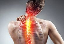Skolyoz nedir? Skolyoz belirtileri neler?