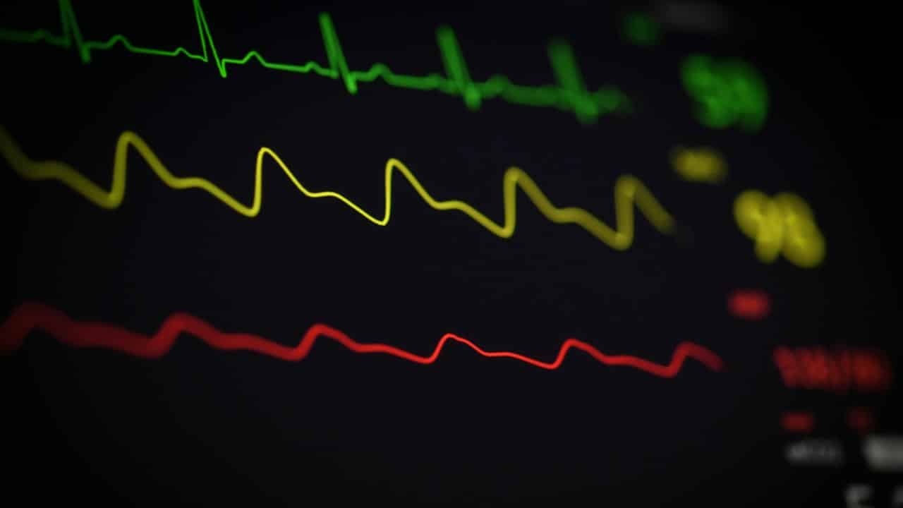 Ekranda EKG çizgisi