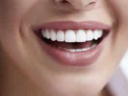 ağrısız diş beyazlatma
